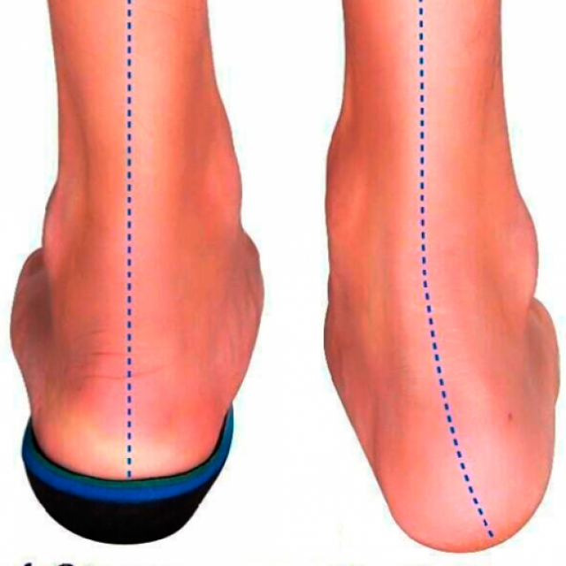 Step by Step Orthotic - Mobility & Gait Center